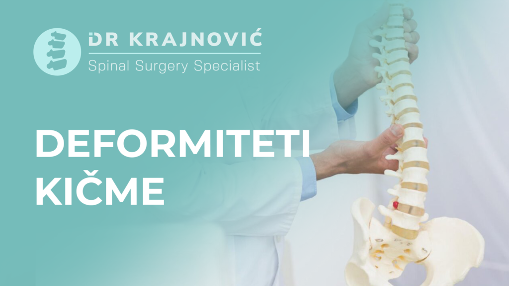 Deformiteti-Kicme