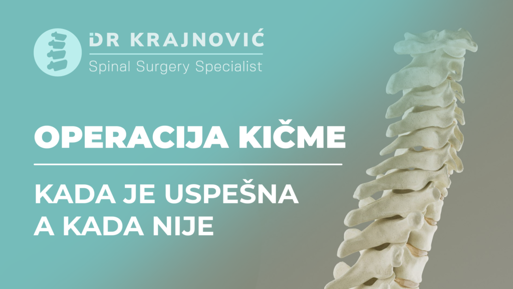 OPERACIJA-KICME---KADA-JE-USPESNA-A-KADA-NIJE